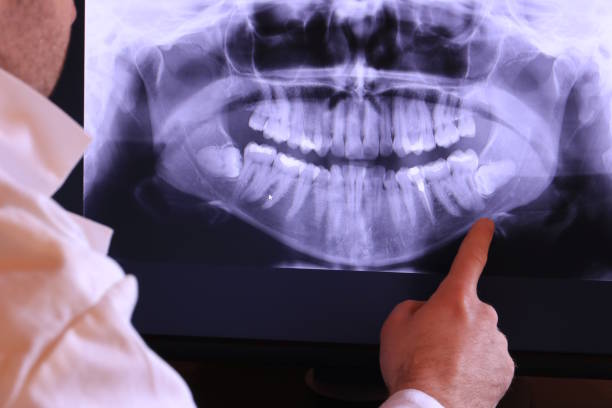 Best Emergency Dentist for Lost Fillings or Crowns in Beaver, OK
