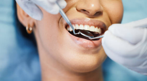 Best Emergency Dentist for Knocked-Out Tooth in Beaver, OK